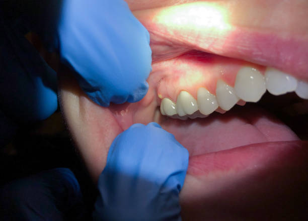 Best Emergency Dental Care for Broken or Chipped Teeth in Sheldon, IL
