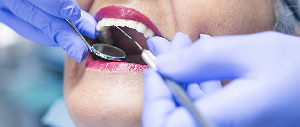 Best Emergency Treatment for Dental Infections or Abscesses in Sheldon, IL